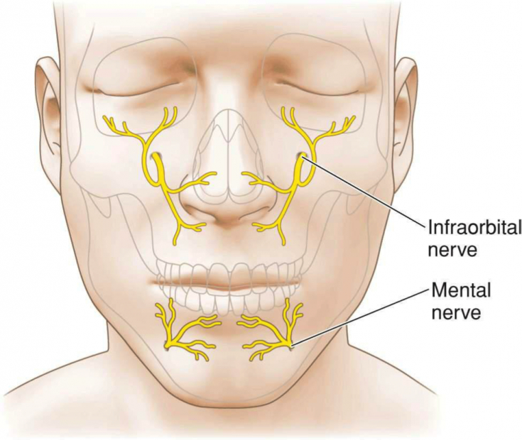 РИС 2. Лицевой нерв. Безопасная контурная пластика губ